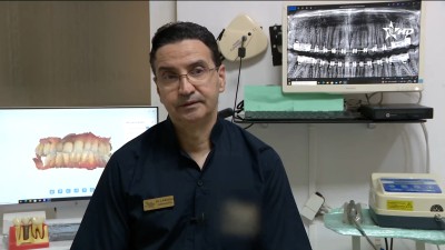 زراعة الأسنان - صحتنا