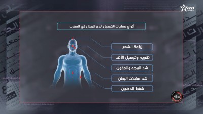  - الرجال والتجميل بين الجراحة والحقن ⁨45 دقيقة: - 45 Dakika
